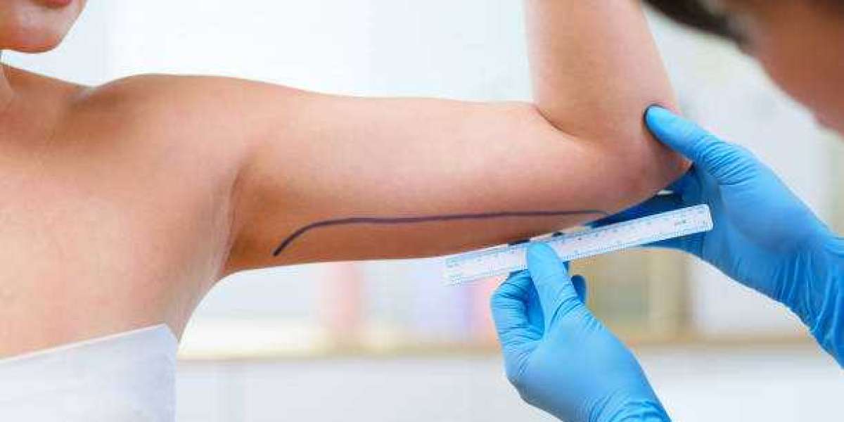 Liposuction in Riyadh: Exploring Advanced Body Sculpting Methods