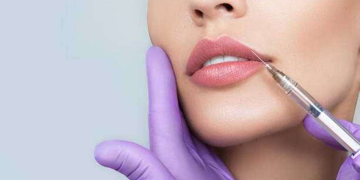 Planning for Lip Reduction Surgery in Riyadh