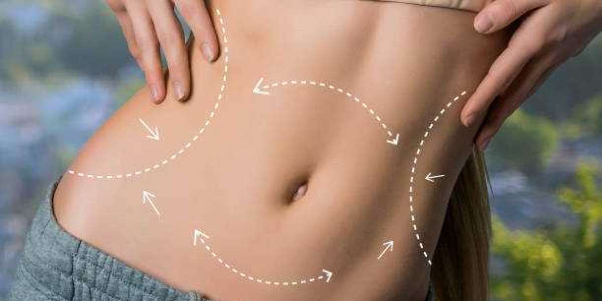 Exploring the Benefits of Fat Melting Injections in Riyadh