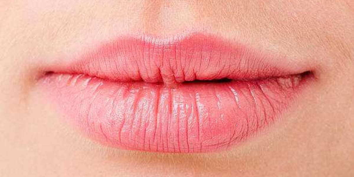 Pink Lips Treatment Deals in Riyadh: A Patient’s Guide