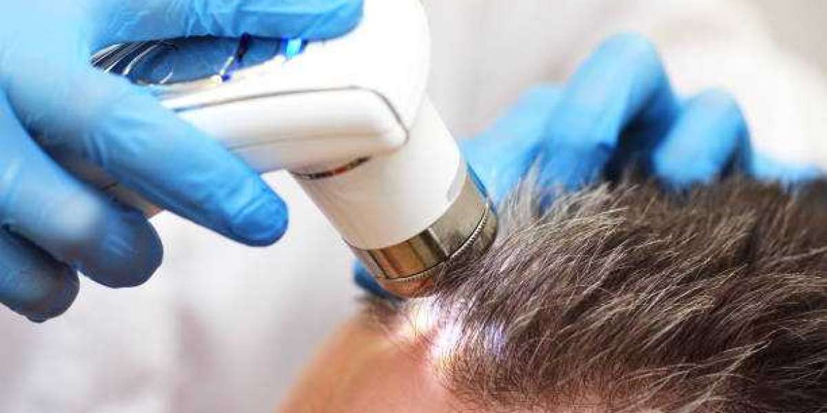 Best Trichologists in Riyadh for Dandruff and Scalp Irritation