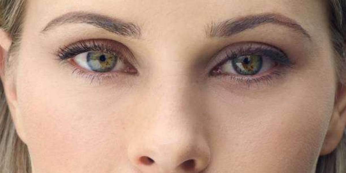 Is Eyelid Surgery Worth the Investment? Benefits and Considerations