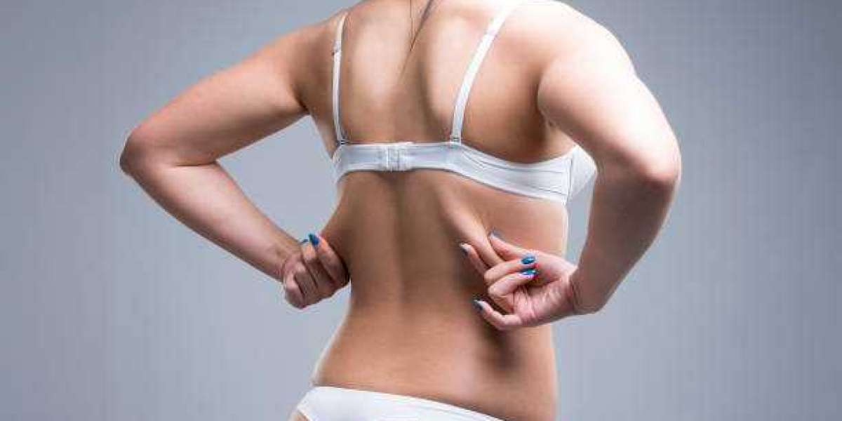 Liposuction Treatment Information for Riyadh Patients