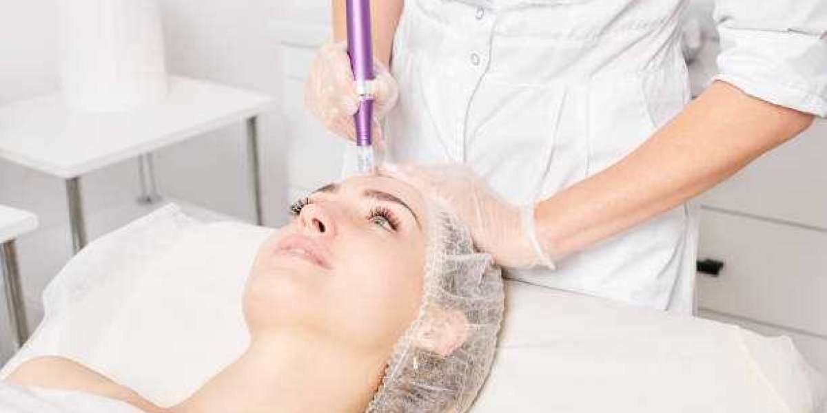 How Dermapen Fits Into a Modern Skincare Routine