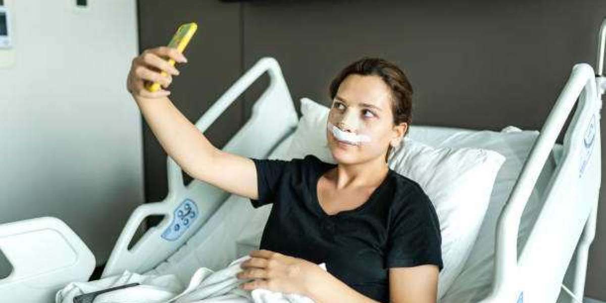 Rhinoplasty in Riyadh: A Guide to Your Treatment Journey
