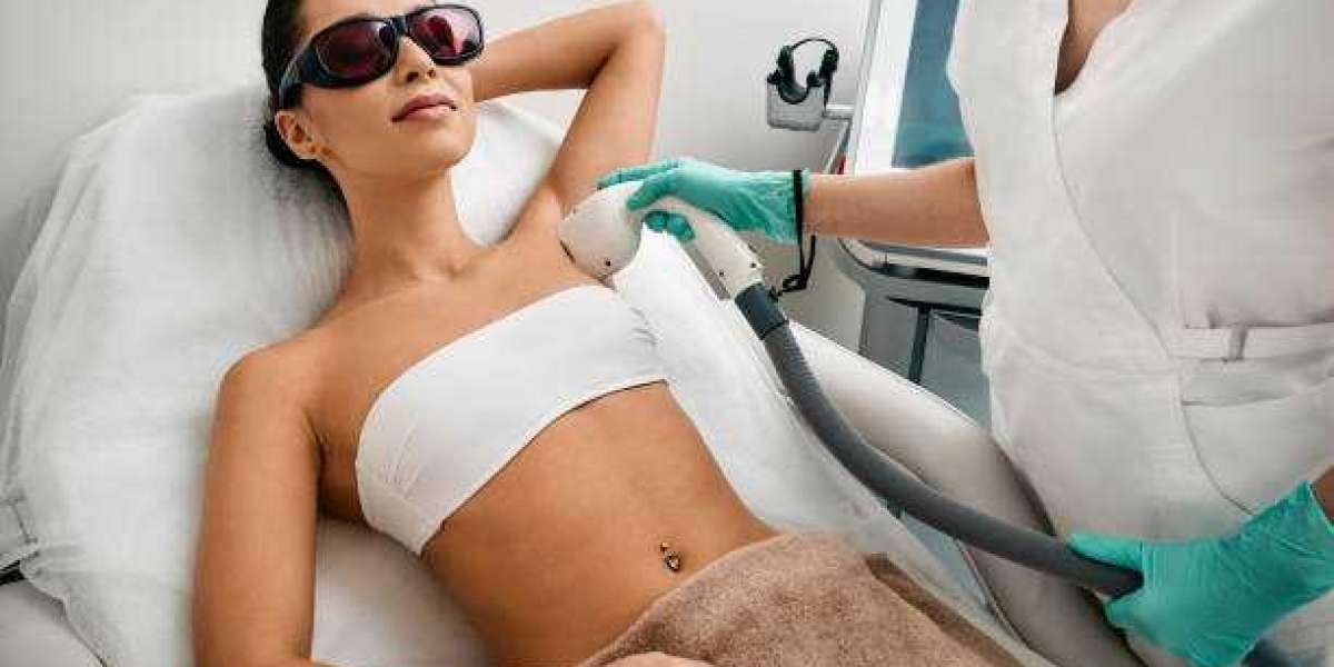 How Many Sessions Are Needed for Laser Hair Removal?